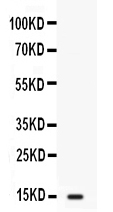 I-FABP / FABP2 Antibody - Western blot analysis of FABP2/I-FABP expression in SW620 whole cell lysates (lane 1). FABP2/I-FABP at 15KD was detected using rabbit anti-FABP2/I-FABP Antigen Affinity purified polyclonal antibody at 0.5 µg/mL. The blot was developed using chemiluminescence (ECL) method.