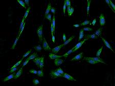 I-FABP / FABP2 Antibody - Immunofluorescence staining of FABP2 in NIH/3T3 cells. Cells were fixed with 4% PFA, permeabilzed with 0.1% Triton X-100 in PBS, blocked with 10% serum, and incubated with rabbit anti-Human FABP2 polyclonal antibody (dilution ratio 1:200) at 4°C overnight. Then cells were stained with the Alexa Fluor 488-conjugated Goat Anti-rabbit IgG secondary antibody (green) and counterstained with DAPI (blue). Positive staining was localized to Cytoplasm.