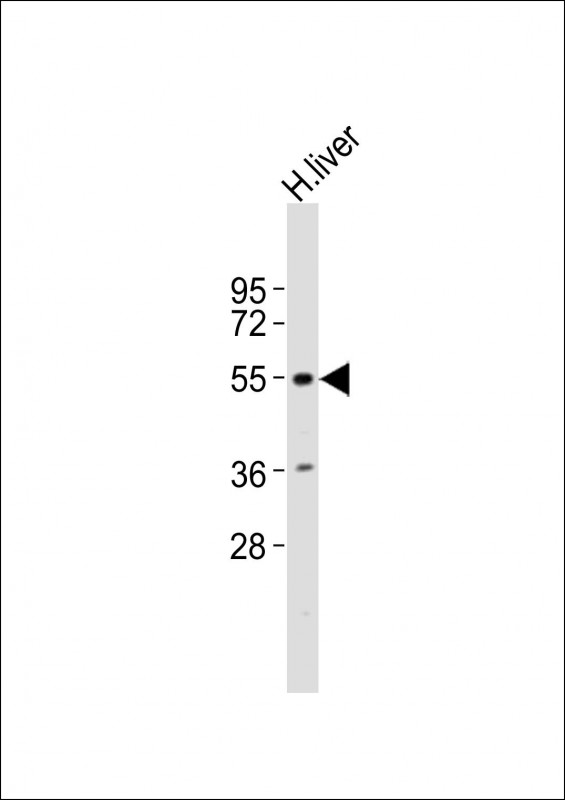 IA-6 / INSM2 Antibody - Anti-INSM2 Antibody at 1:1000 dilution + human liver lysates Lysates/proteins at 20 ug per lane. Secondary Goat Anti-Rabbit IgG, (H+L), Peroxidase conjugated at 1/10000 dilution Predicted band size : 59 kDa Blocking/Dilution buffer: 5% NFDM/TBST.