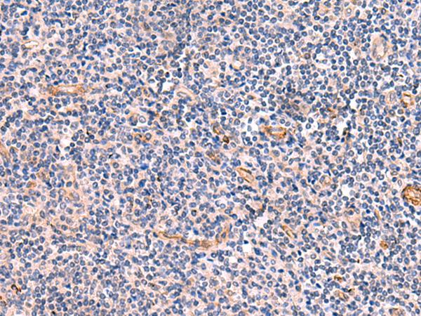 IA-6 / INSM2 Antibody - Immunohistochemistry of paraffin-embedded Human tonsil tissue  using INSM2 Polyclonal Antibody at dilution of 1:35(×200)
