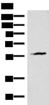 IA-6 / INSM2 Antibody - Western blot analysis of Mouse heart tissue lysate  using INSM2 Polyclonal Antibody at dilution of 1:400