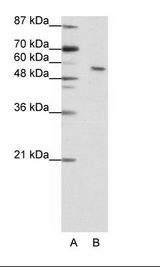 IA-6 / INSM2 Antibody - A: Marker, B: Jurkat Cell Lysate.  This image was taken for the unconjugated form of this product. Other forms have not been tested.