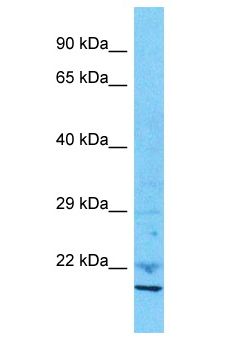 IAH1 Antibody - IAH1 antibody Western Blot of 721_B. Antibody dilution: 1 ug/ml.  This image was taken for the unconjugated form of this product. Other forms have not been tested.