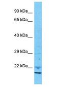 IAH1 Antibody - IAH1 antibody Western Blot of 721_B. Antibody dilution: 1 ug/ml.  This image was taken for the unconjugated form of this product. Other forms have not been tested.