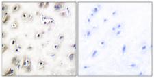 IAPP / Amylin Antibody - Immunohistochemistry analysis of paraffin-embedded human brain tissue, using Amylin Antibody. The picture on the right is blocked with the synthesized peptide.