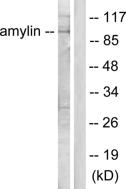 IAPP / Amylin Antibody - Western blot analysis of lysates from HeLa cells, treated with EGF 200ng/ml 30', using Amylin Antibody. The lane on the right is blocked with the synthesized peptide.