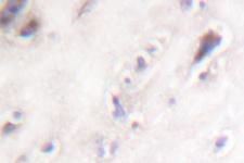 IAPP / Amylin Antibody - IHC of Amylin (H28) pAb in paraffin-embedded human brain pancreas tissue.