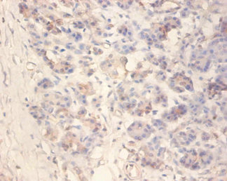 IAPP / Amylin Antibody - Immunohistochemistry of paraffin-embedded human pancreatic tissue using Rabbit anti-human Islet amyloid polypeptide polyclonal Antibody at dilution of 1:100