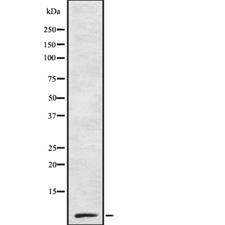 IAPP / Amylin Antibody - Western blot analysis of Amylin using A549 whole lysates.