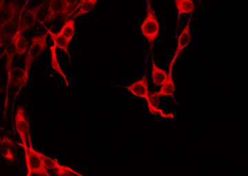 IAPP / Amylin Antibody - Staining HeLa cells by IF/ICC. The samples were fixed with PFA and permeabilized in 0.1% Triton X-100, then blocked in 10% serum for 45 min at 25°C. The primary antibody was diluted at 1:200 and incubated with the sample for 1 hour at 37°C. An Alexa Fluor 594 conjugated goat anti-rabbit IgG (H+L) Ab, diluted at 1/600, was used as the secondary antibody.