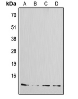 IAPP / Amylin Antibody - Western blot analysis of Amylin expression in MCF7 (A); HeLa (B); mouse kidney (C); rat kidney (D) whole cell lysates.