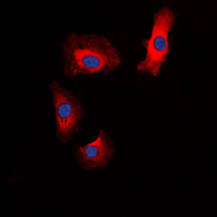 IAPP / Amylin Antibody - Immunofluorescent analysis of Amylin staining in HeLa cells. Formalin-fixed cells were permeabilized with 0.1% Triton X-100 in TBS for 5-10 minutes and blocked with 3% BSA-PBS for 30 minutes at room temperature. Cells were probed with the primary antibody in 3% BSA-PBS and incubated overnight at 4 C in a humidified chamber. Cells were washed with PBST and incubated with a DyLight 594-conjugated secondary antibody (red) in PBS at room temperature in the dark. DAPI was used to stain the cell nuclei (blue).