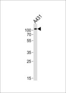 IARS2 Antibody - Western blot of lysate from A431 cell line with IARS2 Antibody. Antibody was diluted at 1:1000. A goat anti-rabbit IgG H&L (HRP) at 1:10000 dilution was used as the secondary antibody. Lysate at 20 ug.