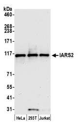 IARS2 Antibody - Detection of human IARS2 by western blot. Samples: Whole cell lysate (15 µg) from HeLa, HEK293T, and Jurkat cells prepared using NETN lysis buffer. Antibody: Affinity purified rabbit anti-IARS2 antibody used for WB at 1:1000. Detection: Chemiluminescence with an exposure time of 30 seconds.