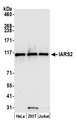 IARS2 Antibody - Detection of human IARS2 by western blot. Samples: Whole cell lysate (15 µg) from HeLa, HEK293T, and Jurkat cells prepared using NETN lysis buffer. Antibody: Affinity purified rabbit anti-IARS2 antibody used for WB at 1:1000. Detection: Chemiluminescence with an exposure time of 30 seconds.