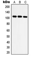 IARS2 Antibody - Western blot analysis of IARS2 expression in Jurkat (A); HT1080 (B); NIH3T3 (C) whole cell lysates.