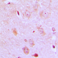 IARS2 Antibody - Immunohistochemical analysis of IARS2 staining in human brain formalin fixed paraffin embedded tissue section. The section was pre-treated using heat mediated antigen retrieval with sodium citrate buffer (pH 6.0). The section was then incubated with the antibody at room temperature and detected using an HRP conjugated compact polymer system. DAB was used as the chromogen. The section was then counterstained with hematoxylin and mounted with DPX.
