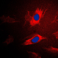 IARS2 Antibody - Immunofluorescent analysis of IARS2 staining in Jurkat cells. Formalin-fixed cells were permeabilized with 0.1% Triton X-100 in TBS for 5-10 minutes and blocked with 3% BSA-PBS for 30 minutes at room temperature. Cells were probed with the primary antibody in 3% BSA-PBS and incubated overnight at 4 C in a humidified chamber. Cells were washed with PBST and incubated with a DyLight 594-conjugated secondary antibody (red) in PBS at room temperature in the dark. DAPI was used to stain the cell nuclei (blue).