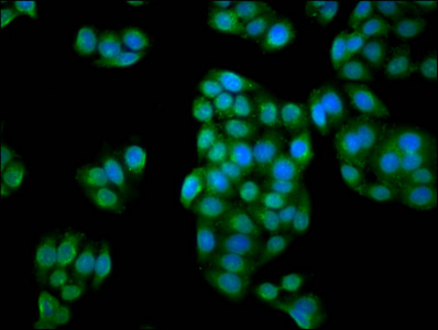 IBA57 / C1orf69 Antibody - Immunofluorescence staining of PC3 cells diluted at 1:133, counter-stained with DAPI. The cells were fixed in 4% formaldehyde, permeabilized using 0.2% Triton X-100 and blocked in 10% normal Goat Serum. The cells were then incubated with the antibody overnight at 4°C.The Secondary antibody was Alexa Fluor 488-congugated AffiniPure Goat Anti-Rabbit IgG (H+L).