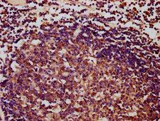 IBA57 / C1orf69 Antibody - Immunohistochemistry Dilution at 1:400 and staining in paraffin-embedded human lymph node tissue performed on a Leica BondTM system. After dewaxing and hydration, antigen retrieval was mediated by high pressure in a citrate buffer (pH 6.0). Section was blocked with 10% normal Goat serum 30min at RT. Then primary antibody (1% BSA) was incubated at 4°C overnight. The primary is detected by a biotinylated Secondary antibody and visualized using an HRP conjugated SP system.