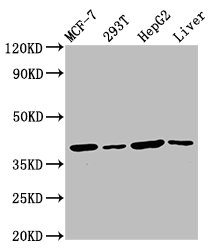 IBA57 / C1orf69 Antibody - Western Blot Positive WB detected in: MCF-7 whole cell lysate, 293T whole cell lysate, HepG2 whole cell lysate, Mouse liver tissue All Lanes: IBA57 antibody at 4.5µg/ml Secondary Goat polyclonal to rabbit IgG at 1/50000 dilution Predicted band size: 39 KDa Observed band size: 39 KDa