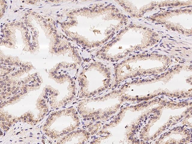 IBA57 / C1orf69 Antibody - Immunochemical staining of human C1orf69 in human prostate with rabbit polyclonal antibody at 1:100 dilution, formalin-fixed paraffin embedded sections.