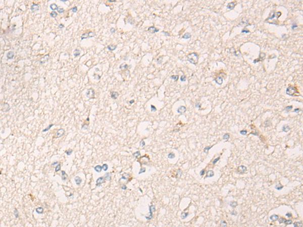 IBA57 / C1orf69 Antibody - Immunohistochemistry of paraffin-embedded Human brain tissue  using IBA57 Polyclonal Antibody at dilution of 1:65(×200)