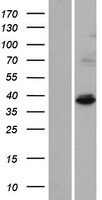 IBA57 / C1orf69 Protein - Western validation with an anti-DDK antibody * L: Control HEK293 lysate R: Over-expression lysate