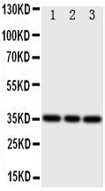 IBSP / Bone Sialoprotein Antibody - Anti-Bone Sialoprotein antibody, Western blotting Lane 1: Rat Liver Tissue LysateLane 2: Rat Brain Tissue LysateLane 3: Rat Kidney Tissue Lysate