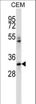 IBSP / Bone Sialoprotein Antibody - IBSP Antibody western blot of CEM cell line lysates (35 ug/lane). The IBSP antibody detected the IBSP protein (arrow).
