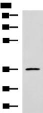 IBSP / Bone Sialoprotein Antibody - Western blot analysis of Jurkat cell lysate  using IBSP Polyclonal Antibody at dilution of 1:700