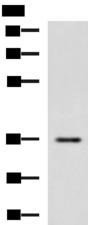 IBSP / Bone Sialoprotein Antibody - Western blot analysis of Human fetal liver tissue lysate  using IBSP Polyclonal Antibody at dilution of 1:650