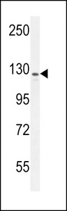 IBTK Antibody - IBTK Antibody western blot of MDA-MB435 cell line lysates (35 ug/lane). The IBTK antibody detected the IBTK protein (arrow).