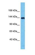 IBTK Antibody - Western blot of IBTK Antibody with human 293T Whole Cell lysate.  This image was taken for the unconjugated form of this product. Other forms have not been tested.