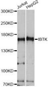 IBTK Antibody - Western blot analysis of extracts of various cell lines, using IBTK antibody at 1:1000 dilution. The secondary antibody used was an HRP Goat Anti-Rabbit IgG (H+L) at 1:10000 dilution. Lysates were loaded 25ug per lane and 3% nonfat dry milk in TBST was used for blocking. An ECL Kit was used for detection and the exposure time was 1s.