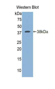 ICA69 / ICA1 Antibody - Western blot of recombinant ICA69 / ICA1.  This image was taken for the unconjugated form of this product. Other forms have not been tested.
