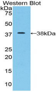 ICA69 / ICA1 Antibody - Western blot of recombinant ICA69 / ICA1.  This image was taken for the unconjugated form of this product. Other forms have not been tested.