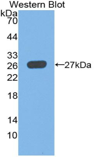 ICA69 / ICA1 Antibody - Western Blot; Sample: Recombinant protein.