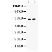 ICA69 / ICA1 Antibody - ICA1 antibody Western blot. All lanes: Anti ICA1 at 0.5 ug/ml. Lane 1: Rat Brain Tissue Lysate at 50 ug. Lane 2: Mouse Pancreas Tissue Lysate at 50 ug. Predicted band size: 55 kD. Observed band size: 55 kD.