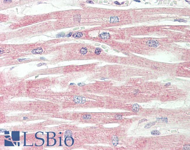 ICA69 / ICA1 Antibody - Human, Heart: Formalin-Fixed Paraffin-Embedded (FFPE).  This image was taken for the unconjugated form of this product. Other forms have not been tested.