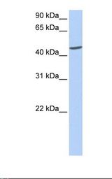 ICA69 / ICA1 Antibody - Human muscle lysate. Antibody concentration: 1.0 ug/ml. Gel concentration: 12%.  This image was taken for the unconjugated form of this product. Other forms have not been tested.