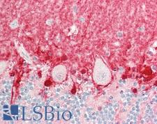 ICA69 / ICA1 Antibody - Human Brain, Cerebellum: Formalin-Fixed, Paraffin-Embedded (FFPE).  This image was taken for the unconjugated form of this product. Other forms have not been tested.