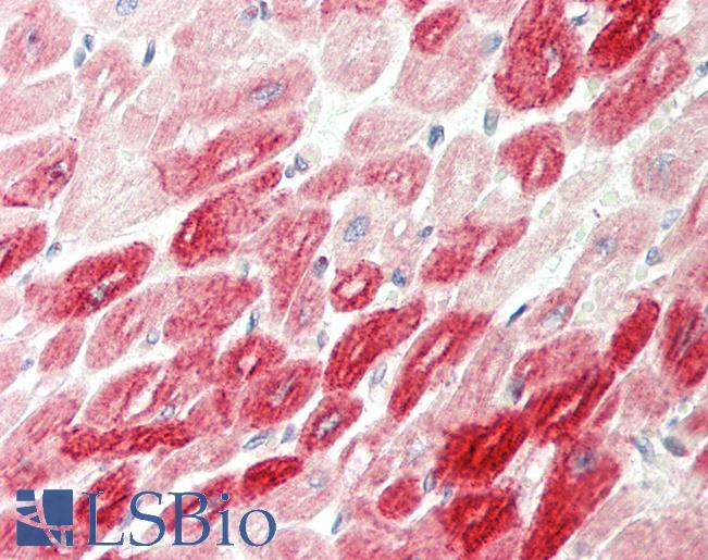ICA69 / ICA1 Antibody - Human Heart: Formalin-Fixed, Paraffin-Embedded (FFPE).  This image was taken for the unconjugated form of this product. Other forms have not been tested.