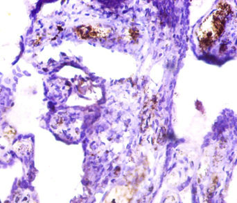 ICA69 / ICA1 Antibody - Immunohistochemistry of paraffin-embedded human placenta tissue using ICA1 Antibody at dilution of 1:50