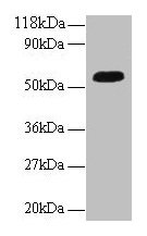 ICA69 / ICA1 Antibody - Western blot All lanes: Islet cell autoantigen 1 antibody at 2µg/ml + A549 whole cell lysate Secondary Goat polyclonal to rabbit IgG at 1/10000 dilution Predicted band size: 55, 58 kDa Observed band size: 55 kDa