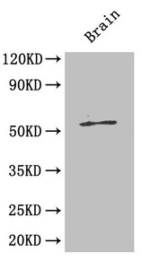 ICA69 / ICA1 Antibody - Western Blot Positive WB detected in: Mouse brain All lanes: ICA1 antibody at 4µg/ml Secondary Goat polyclonal to rabbit IgG at 1/50000 dilution Predicted band size: 55, 58 kDa Observed band size: 55 kDa