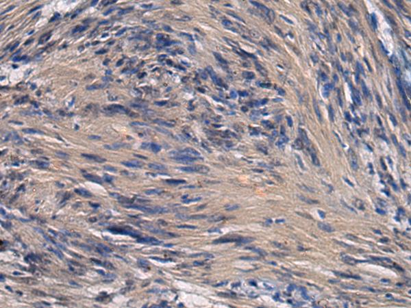 ICA69 / ICA1 Antibody - Immunohistochemistry of paraffin-embedded Human brain tissue  using ICA1 Polyclonal Antibody at dilution of 1:70(×200)