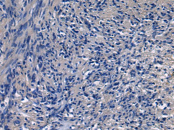 ICA69 / ICA1 Antibody - Immunohistochemistry of paraffin-embedded Human brain tissue  using ICA1 Polyclonal Antibody at dilution of 1:50(×200)