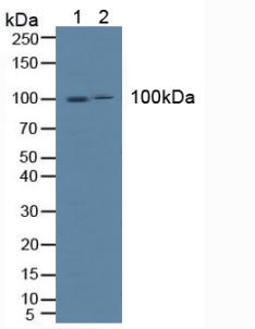 ICAM-1 / CD54 Antibody - Western Blot; Sample: Lane1: Human Hela Cells; Lane2: Human K562 Cells.