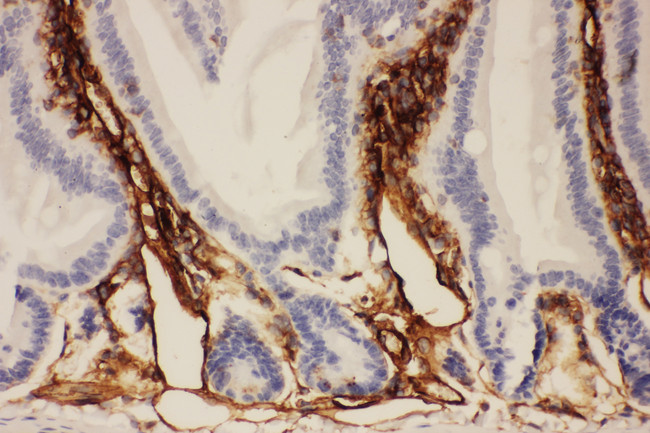 ICAM-1 / CD54 Antibody - ICAM1 / CD54 antibody. IHC(P): Mouse Intestine Tissue.